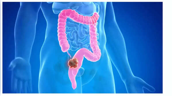 Image representing weight loss, a common symptom of cancer